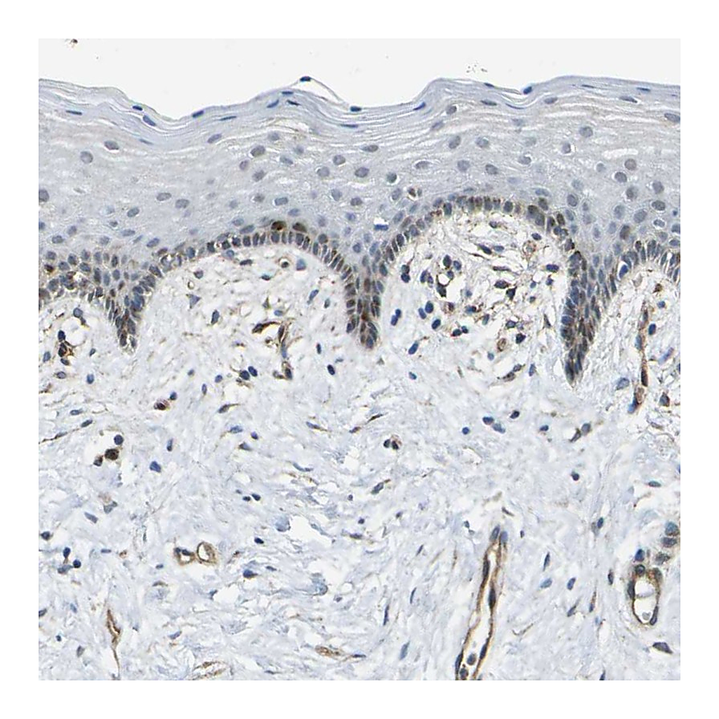 Atlas Antibodies Anti-ECE1 Antibody
