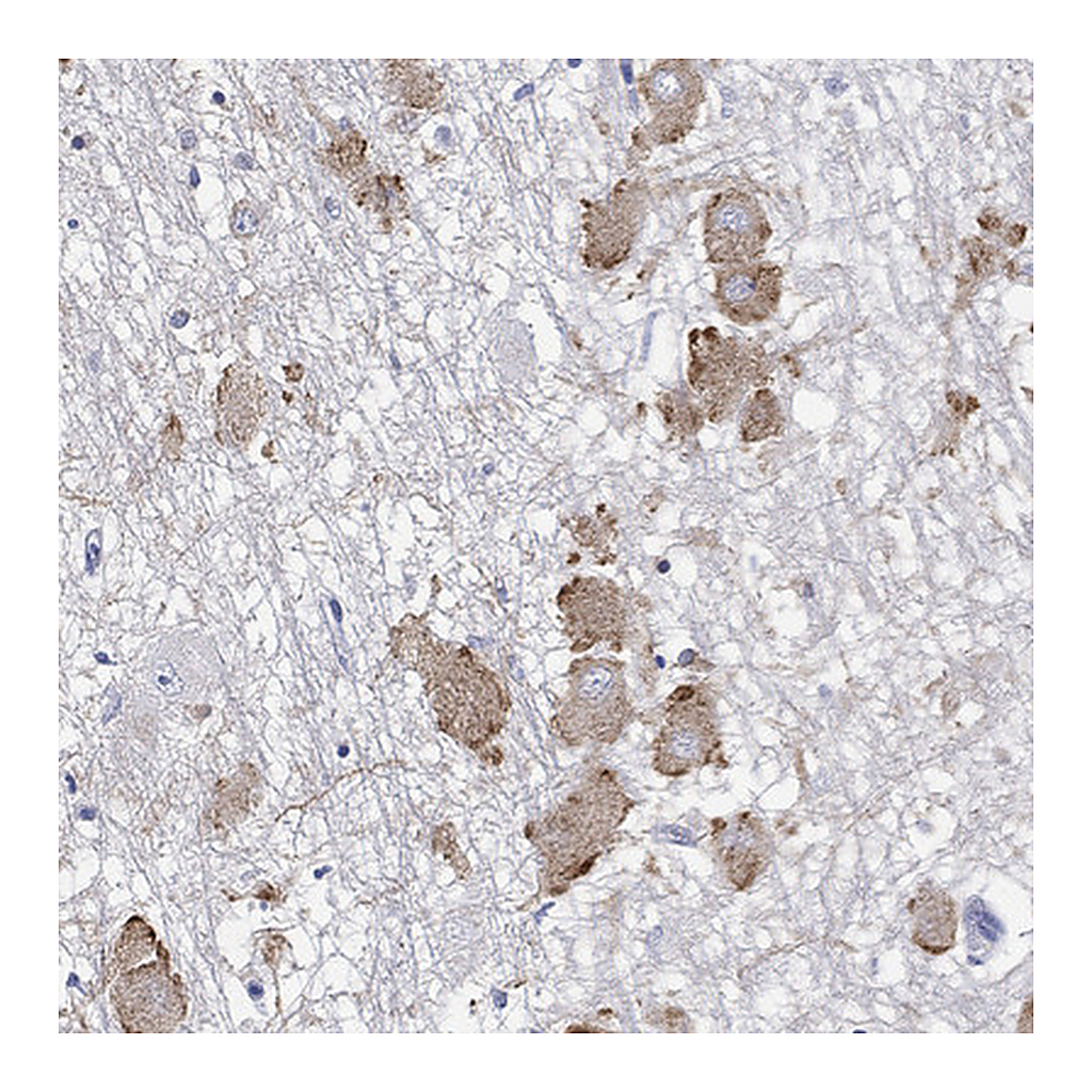 Atlas Antibodies Anti-ECEL1 Antibody