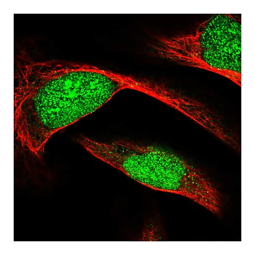 Atlas Antibodies Anti-ECE2 Antibody