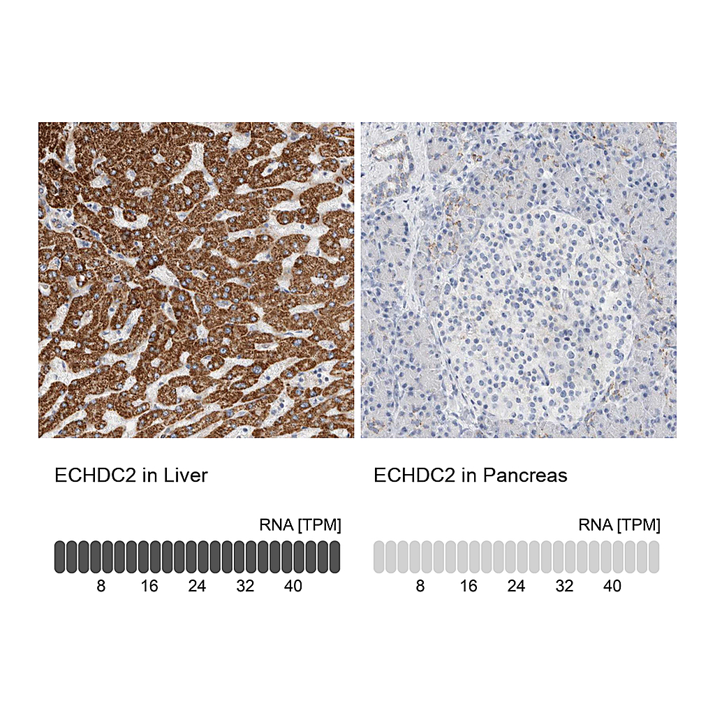 Atlas Antibodies Anti-ECHDC2 Antibody