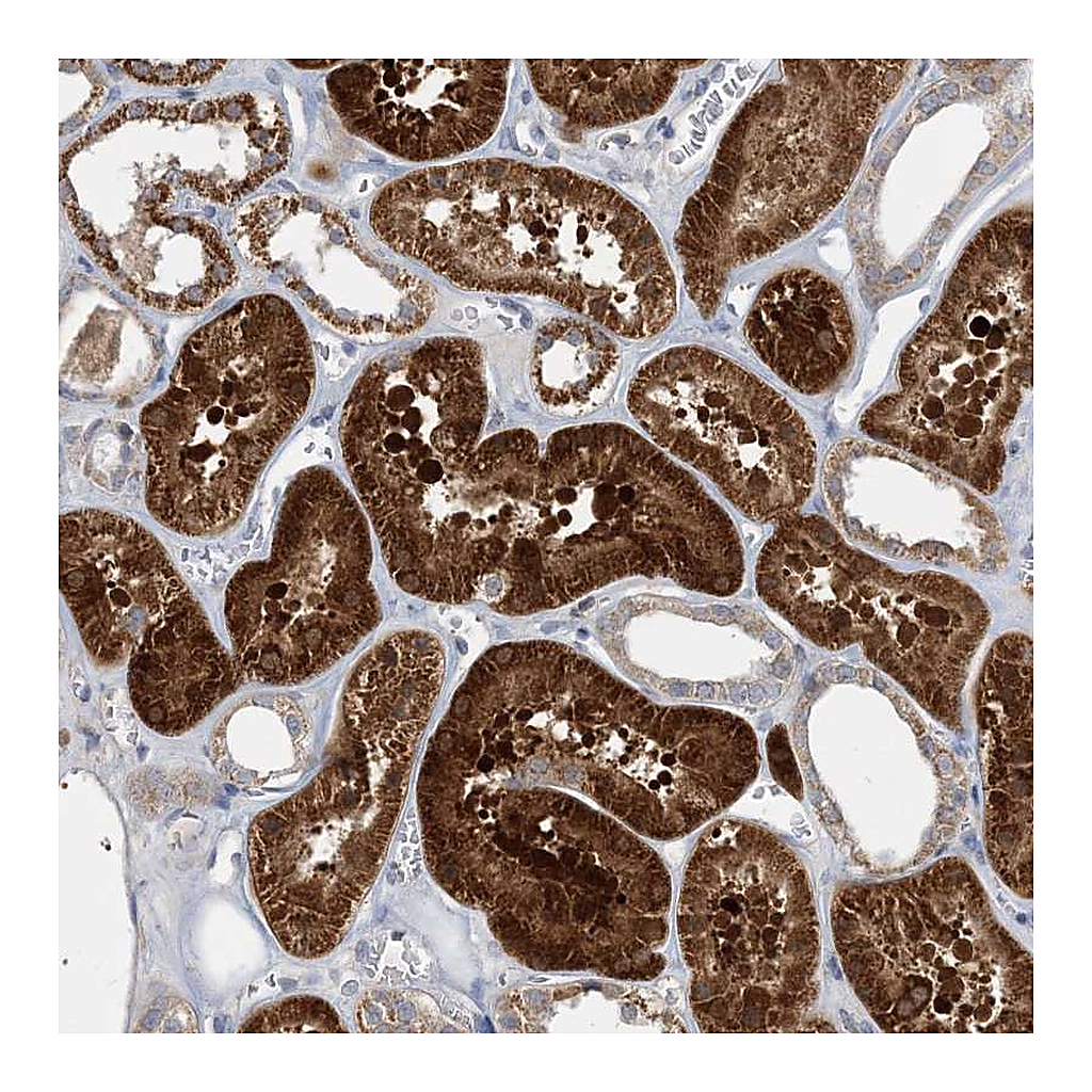 Atlas Antibodies Anti-ECHDC1 Antibody
