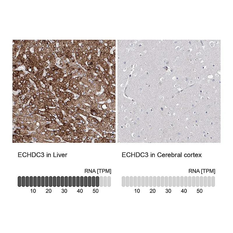 Atlas Antibodies Anti-ECHDC3 Antibody