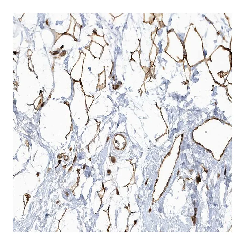 Atlas Antibodies Anti-ECM2 Antibody