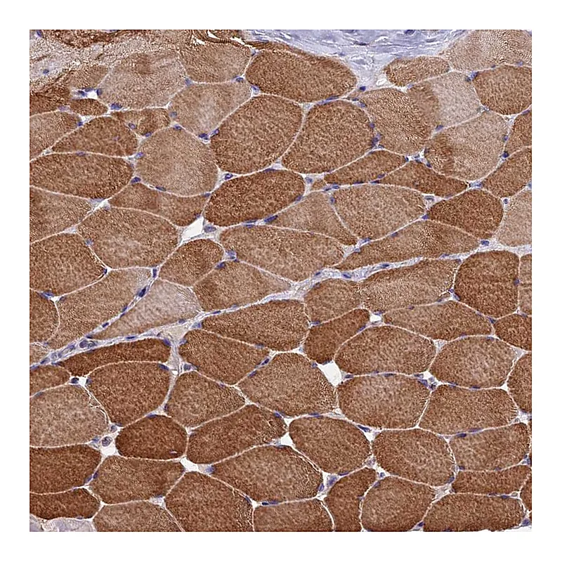 Atlas Antibodies Anti-ECSIT Antibody