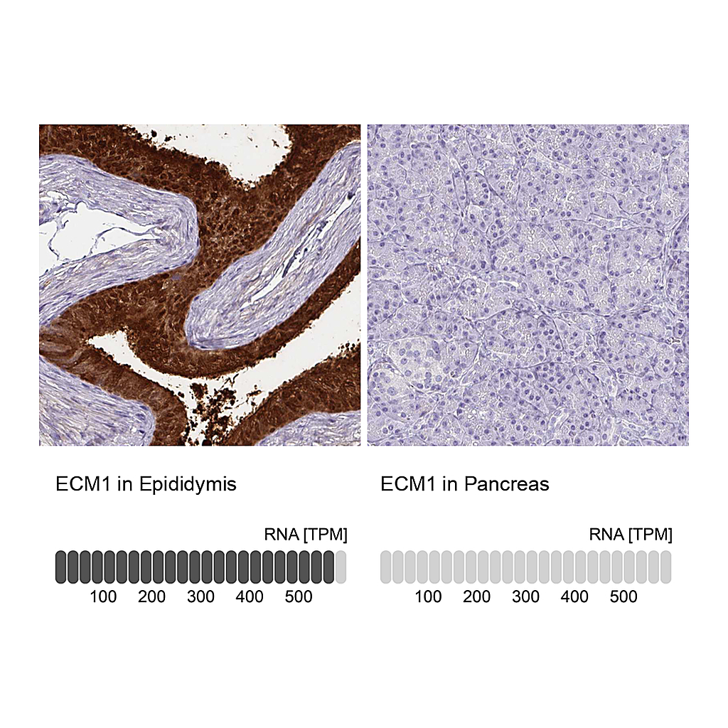 Atlas Antibodies Anti-ECM1 Antibody
