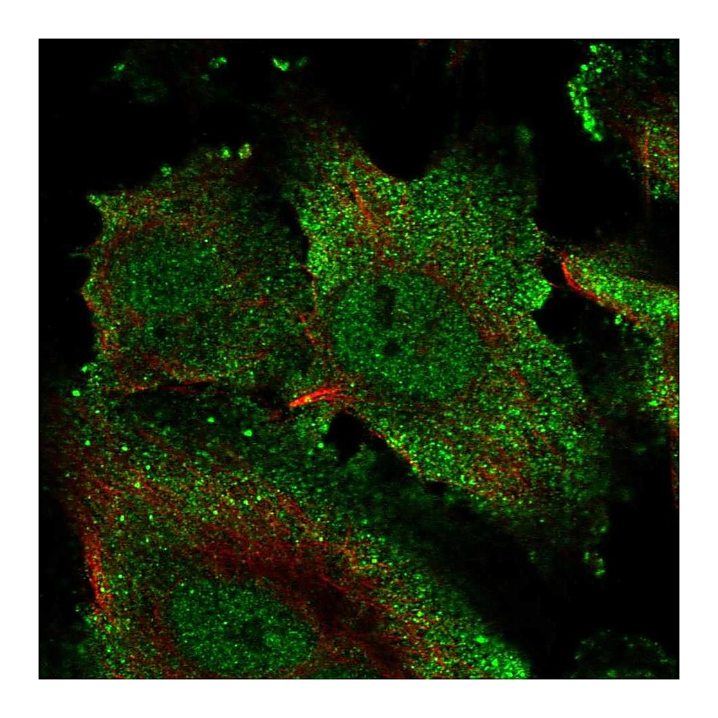 Atlas Antibodies Anti-ECSCR Antibody