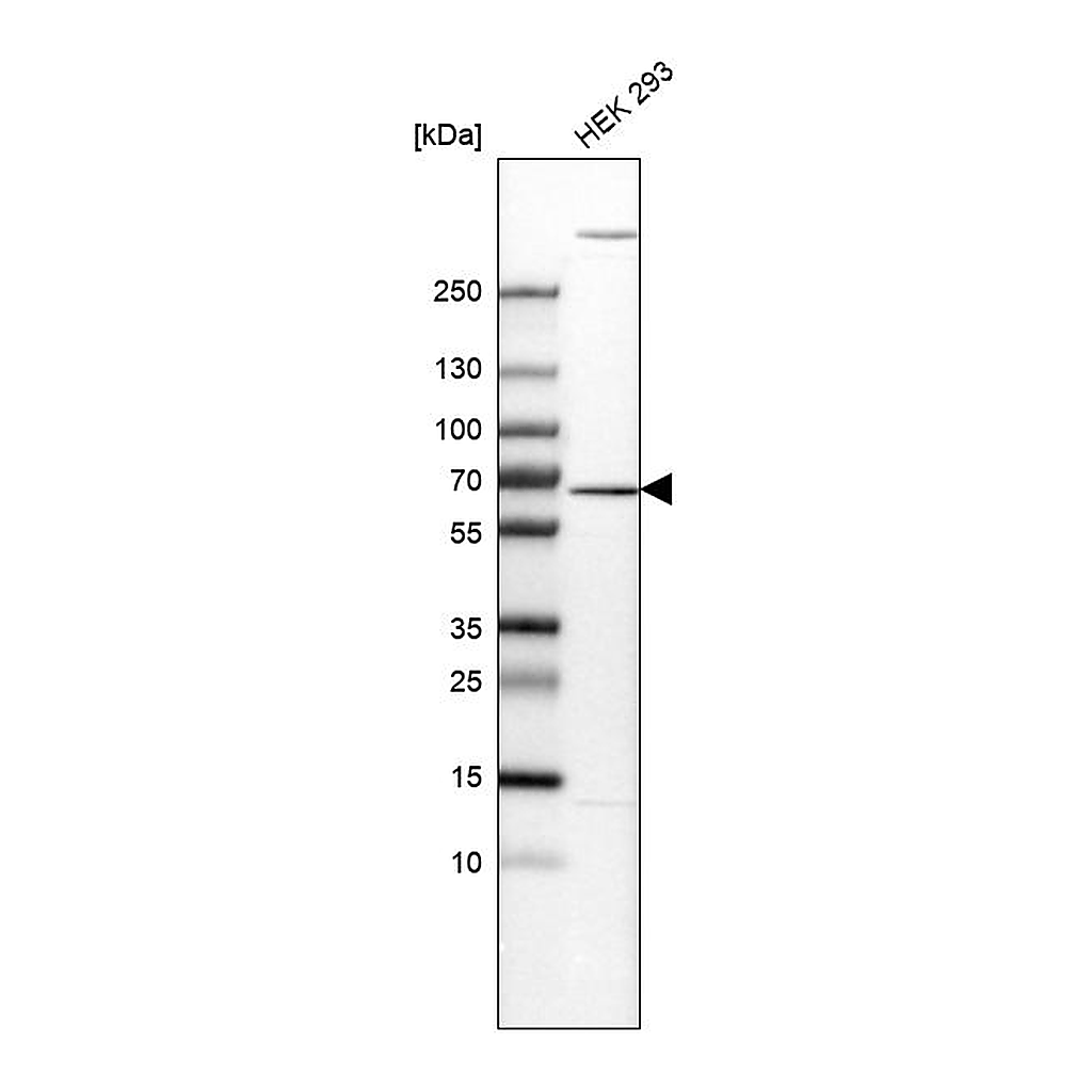 Atlas Antibodies Anti-EDC3 Antibody