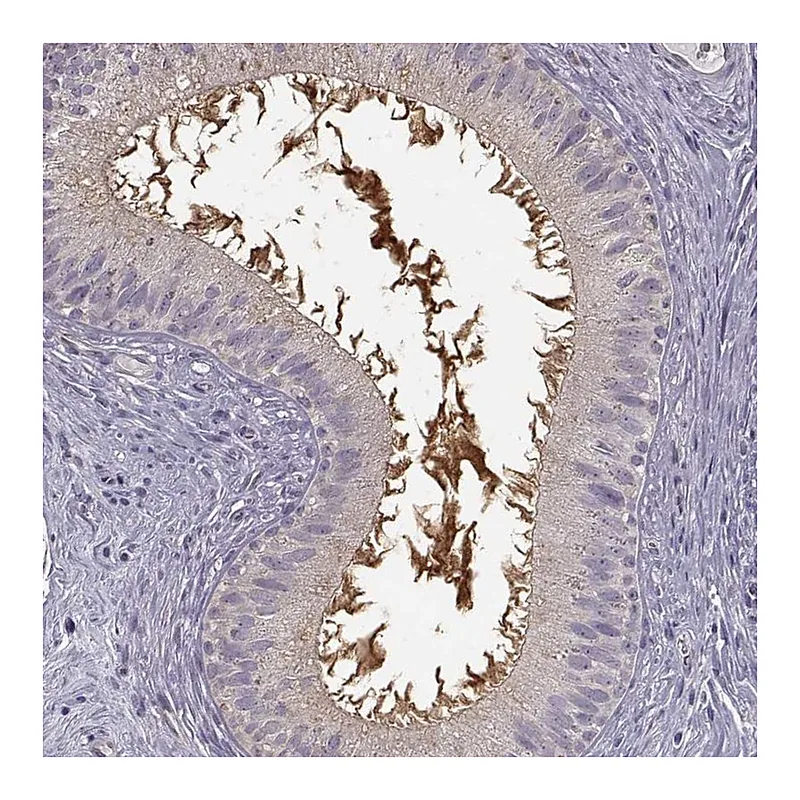 Atlas Antibodies Anti-EDDM3B Antibody