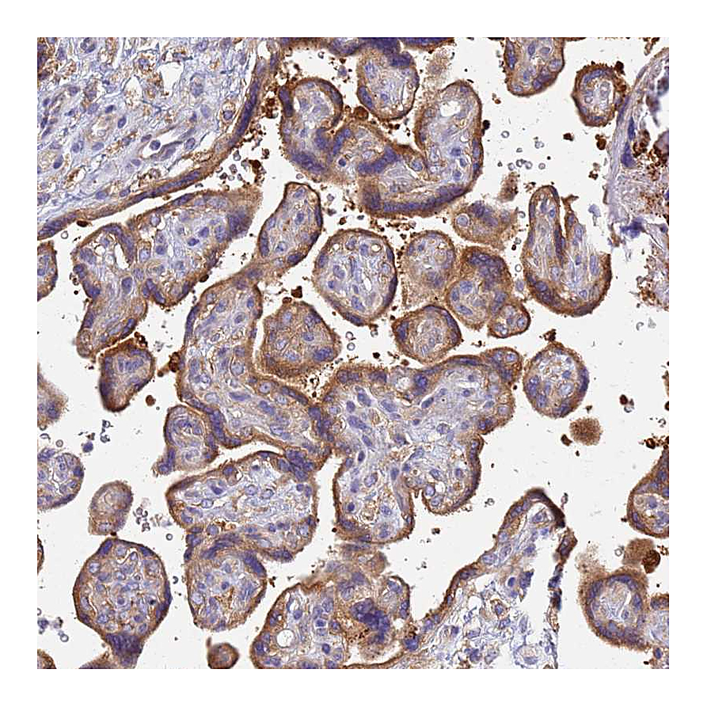 Atlas Antibodies Anti-EEA1 Antibody