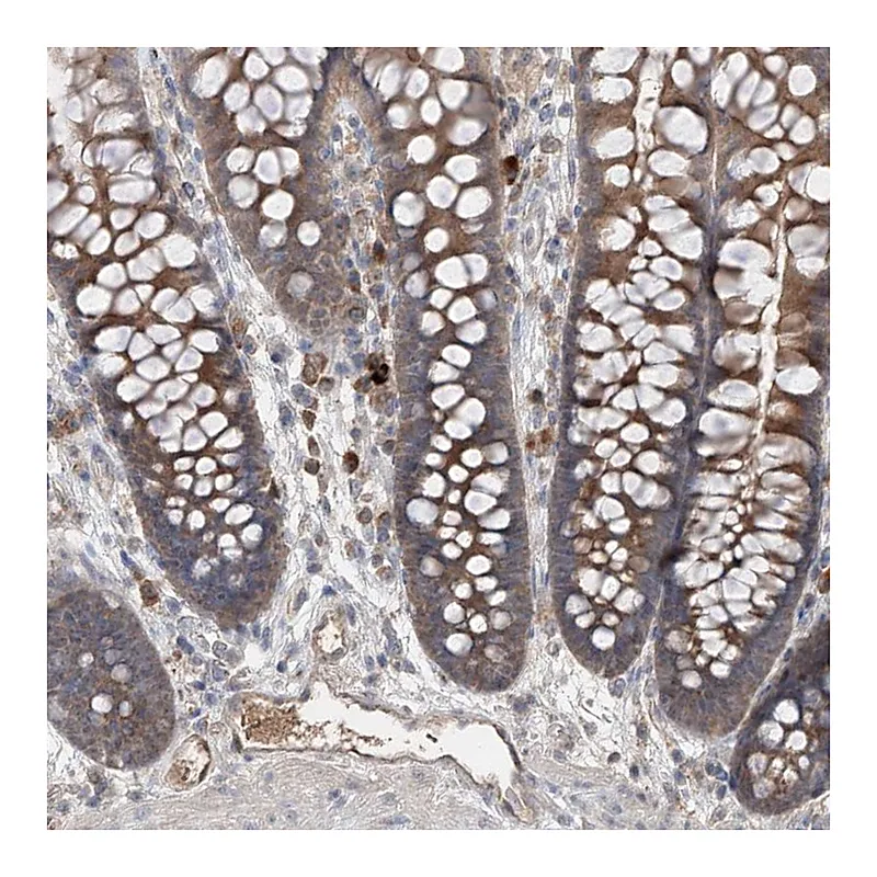 Atlas Antibodies Anti-EDN1 Antibody