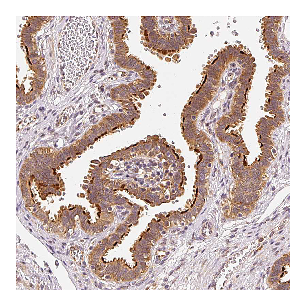 Atlas Antibodies Anti-EEF1A1 Antibody