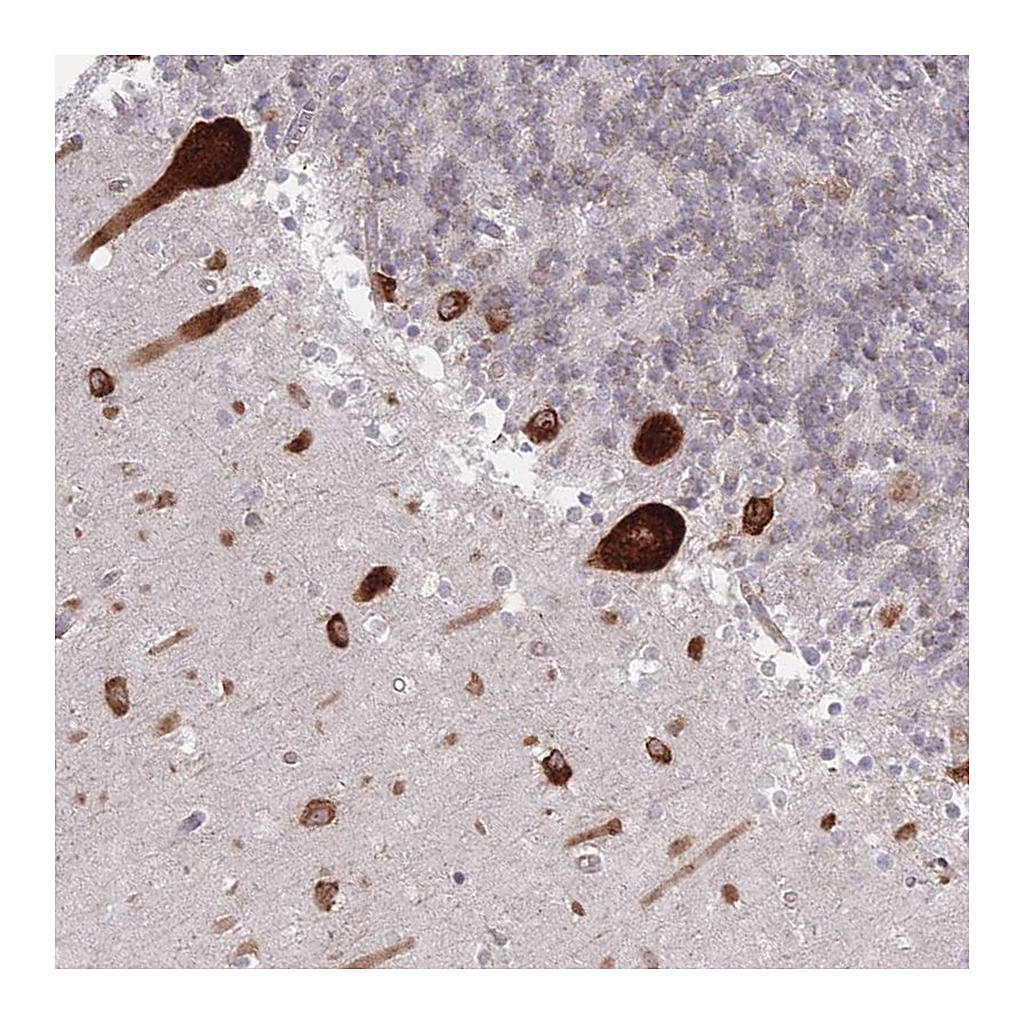 Atlas Antibodies Anti-EEF1B2 Antibody