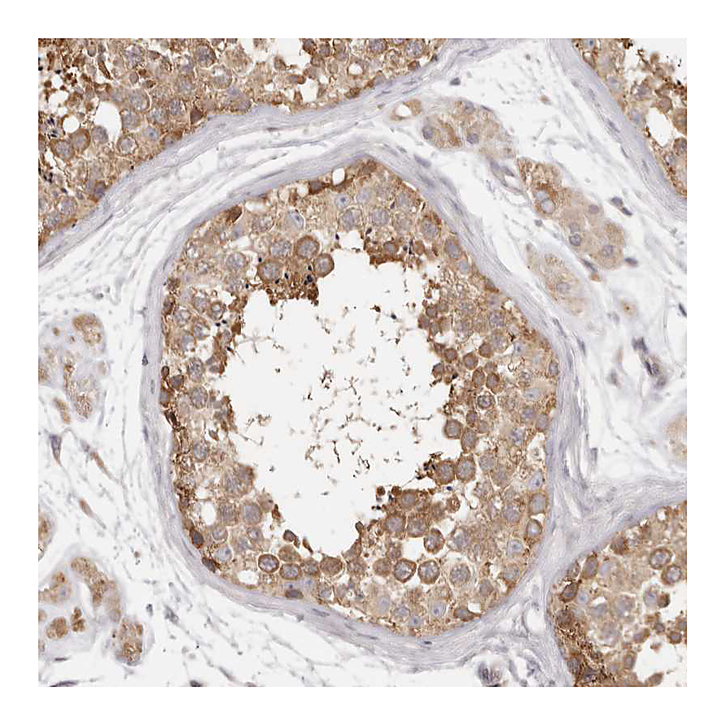 Atlas Antibodies Anti-EEF1E1 Antibody