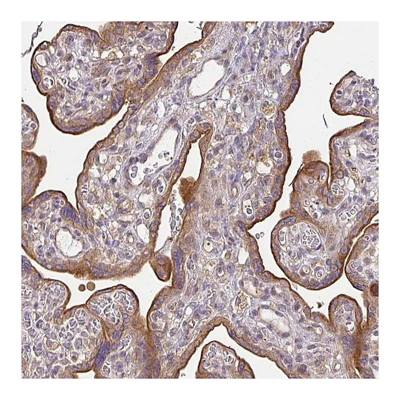 Atlas Antibodies Anti-EEF1AKMT1 Antibody