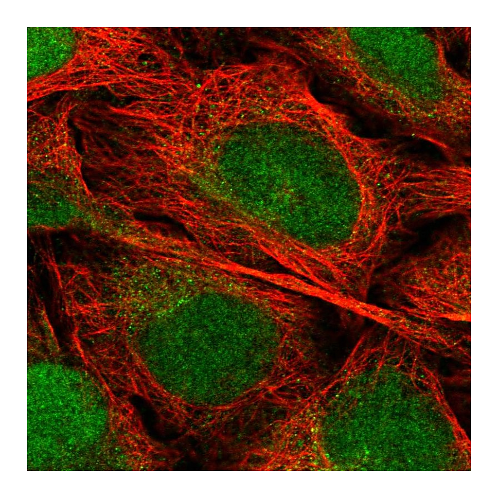Atlas Antibodies Anti-EEF1E1 Antibody