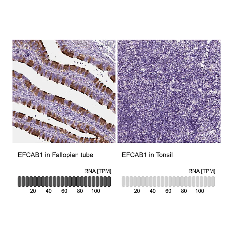 Atlas Antibodies Anti-EFCAB1 Antibody