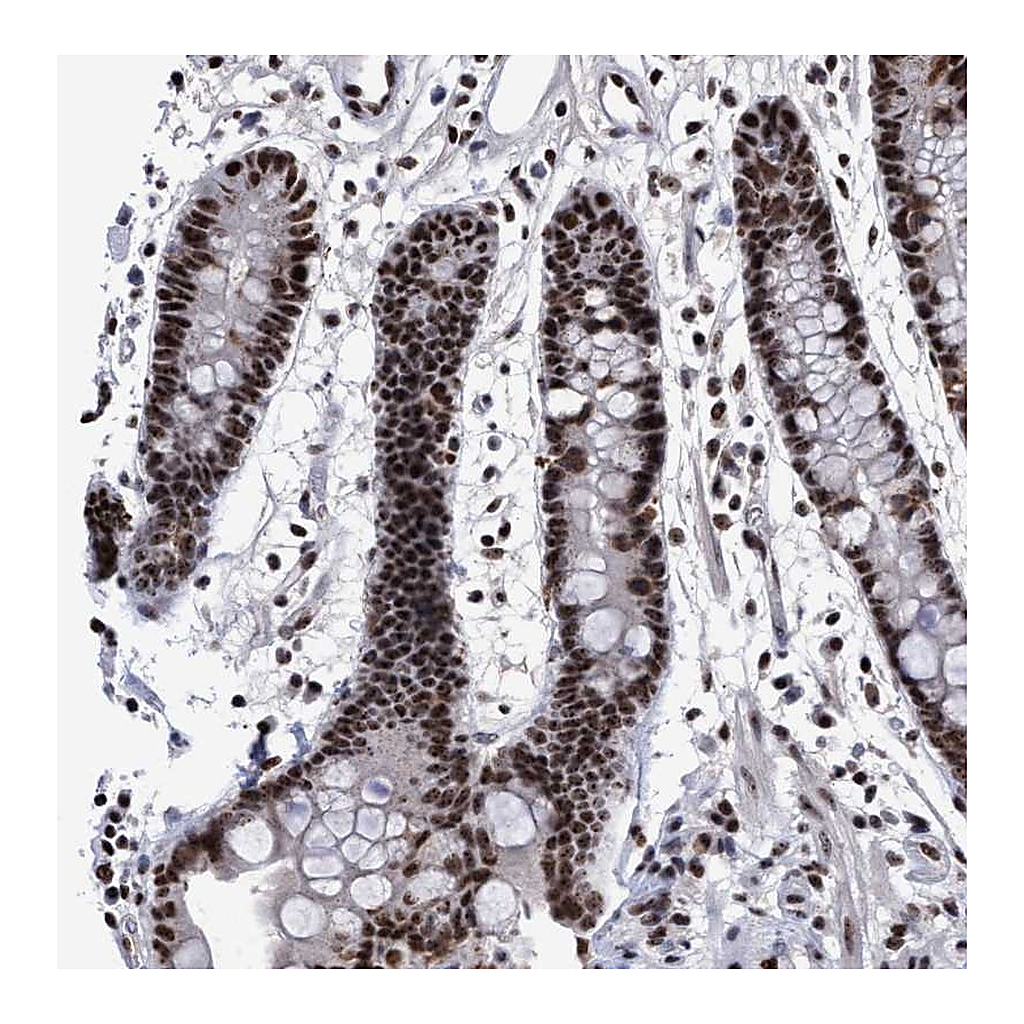Atlas Antibodies Anti-EFCAB10 Antibody
