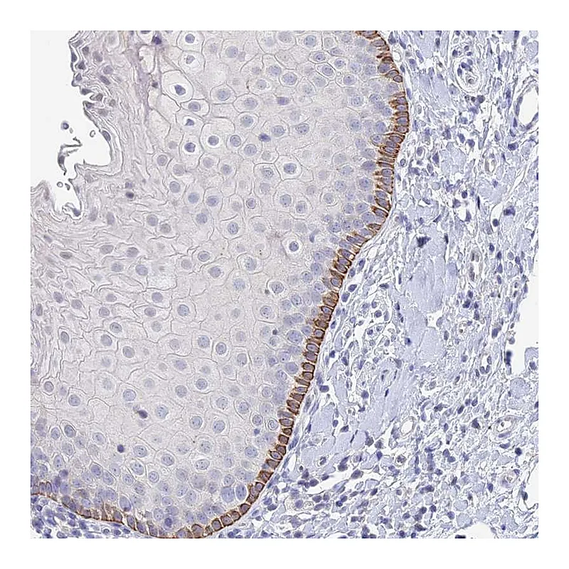Atlas Antibodies Anti-EEF2KMT Antibody