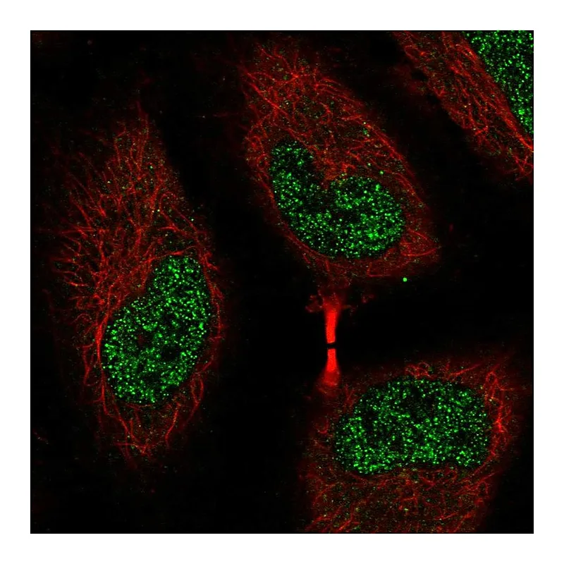 Atlas Antibodies Anti-EEF2K Antibody