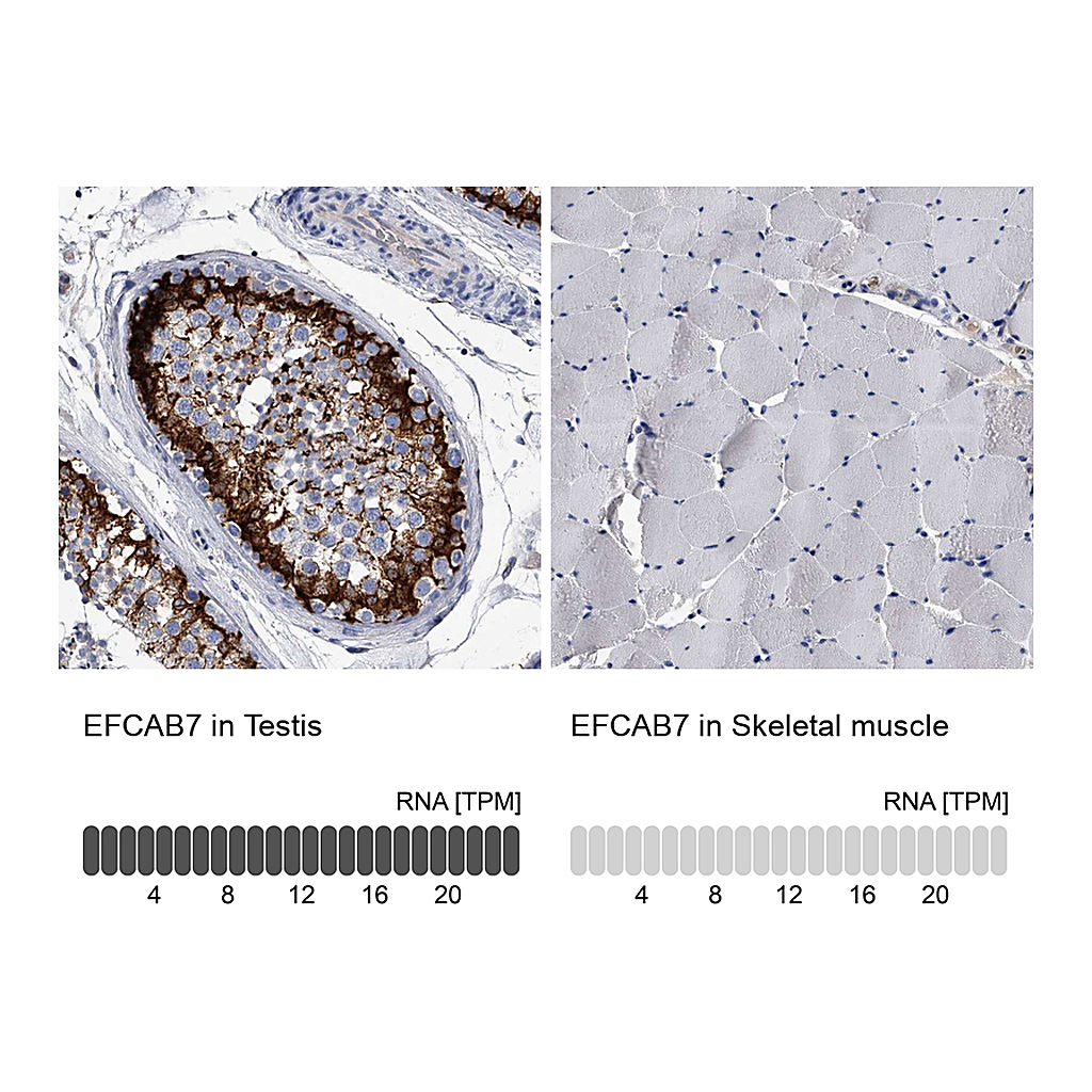 Atlas Antibodies Anti-EFCAB7 Antibody