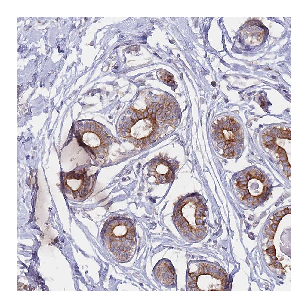 Atlas Antibodies Anti-EFCC1 Antibody