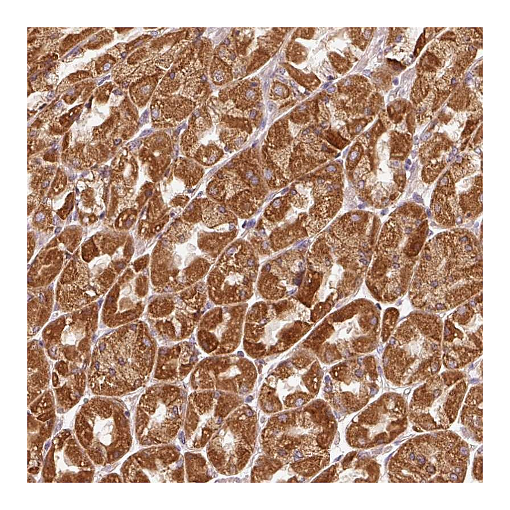 Atlas Antibodies Anti-EFHC1 Antibody