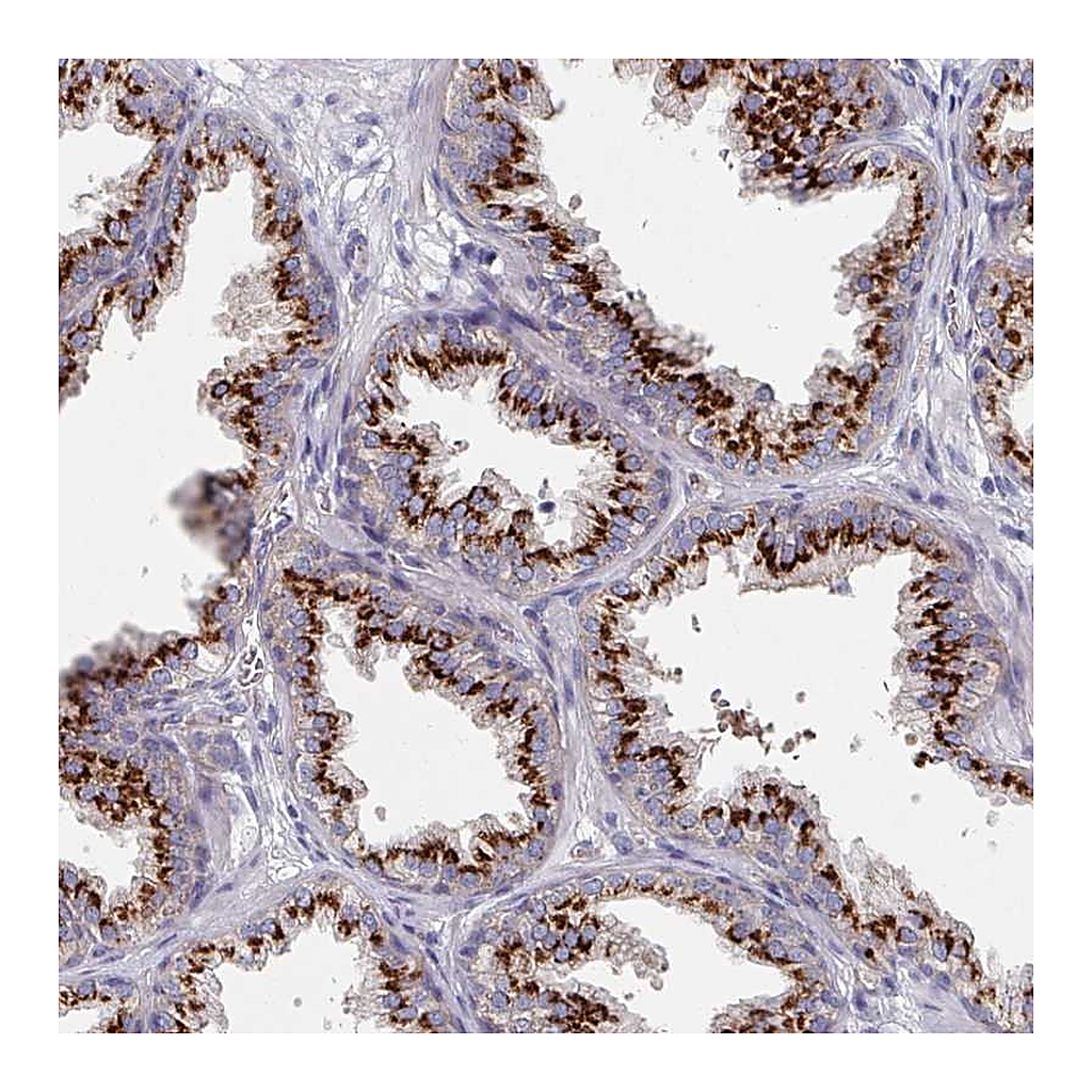 Atlas Antibodies Anti-EFL1 Antibody