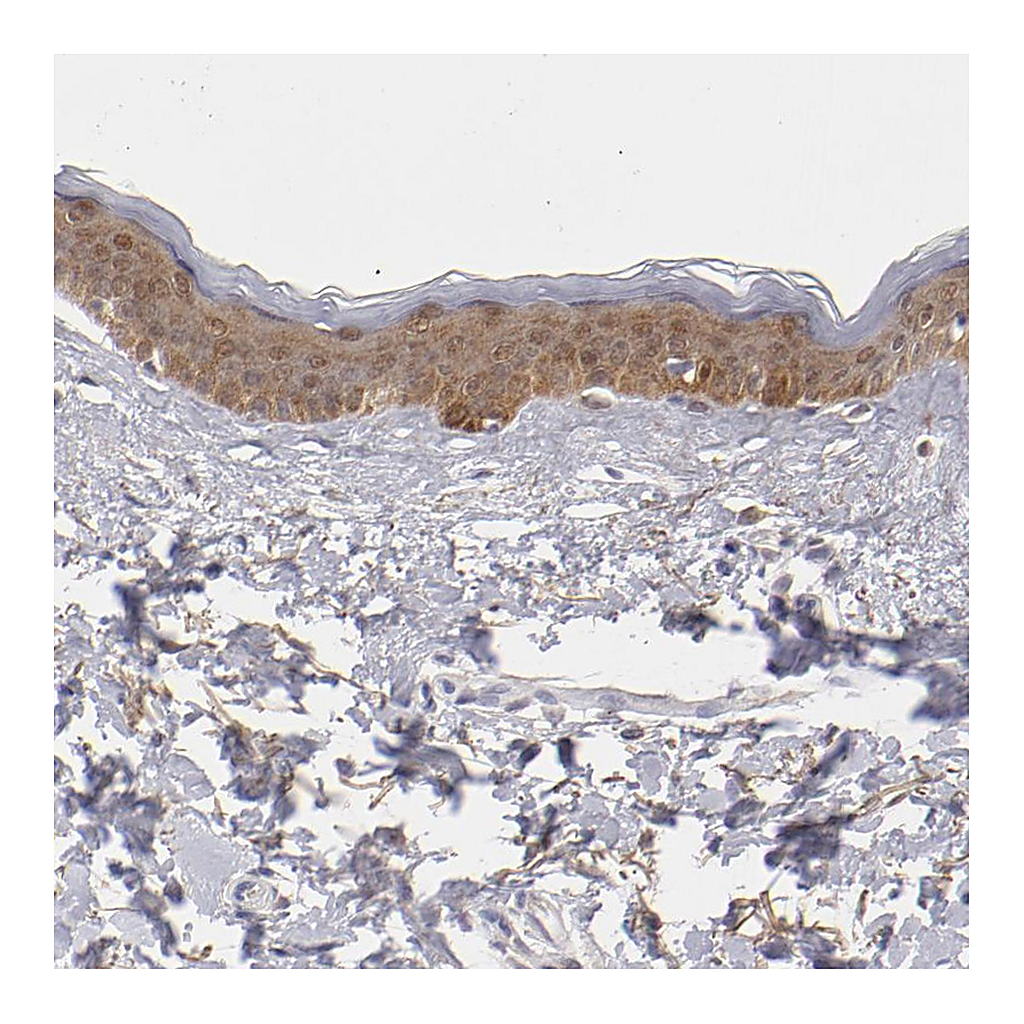 Atlas Antibodies Anti-EFS Antibody