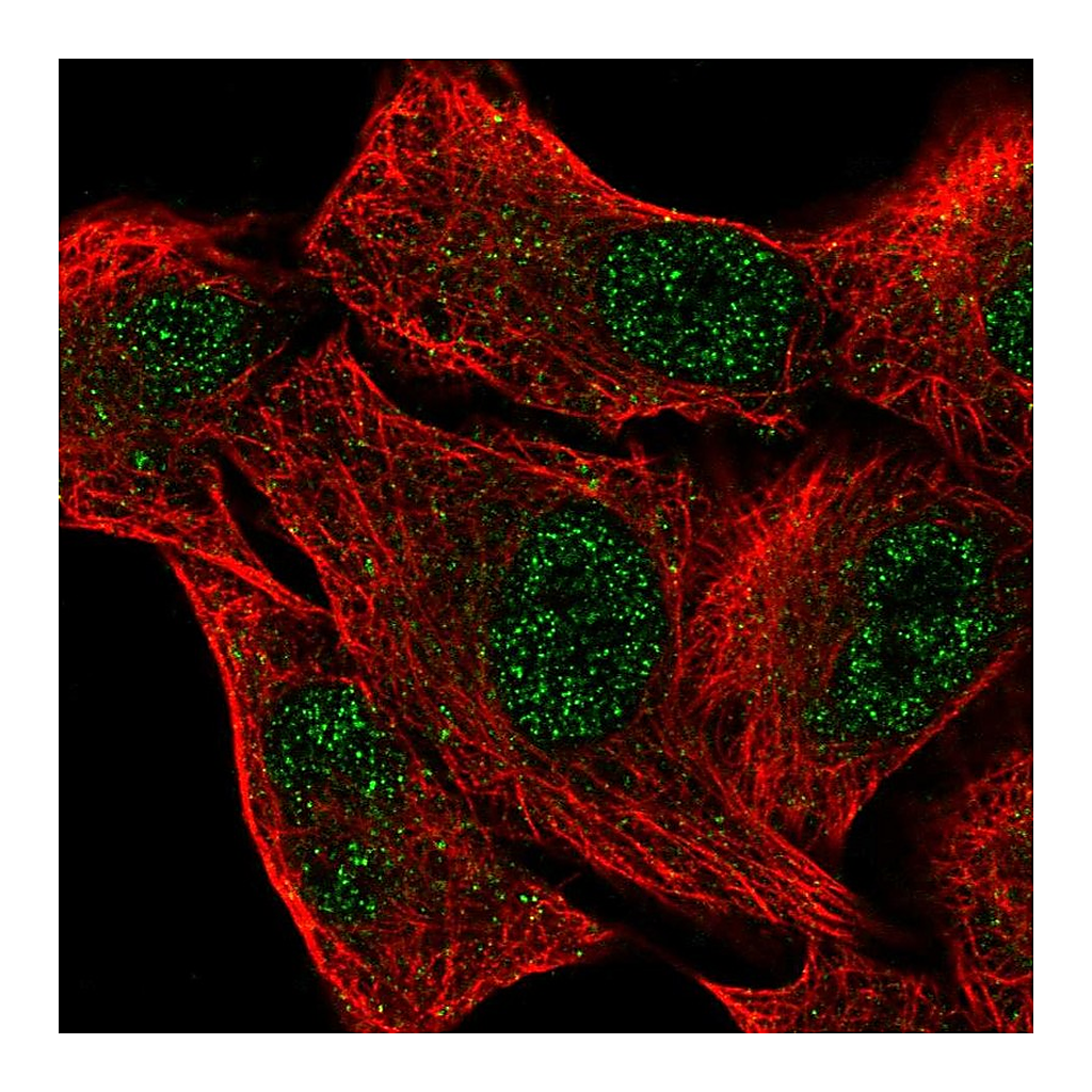 Atlas Antibodies Anti-EGLN2 Antibody