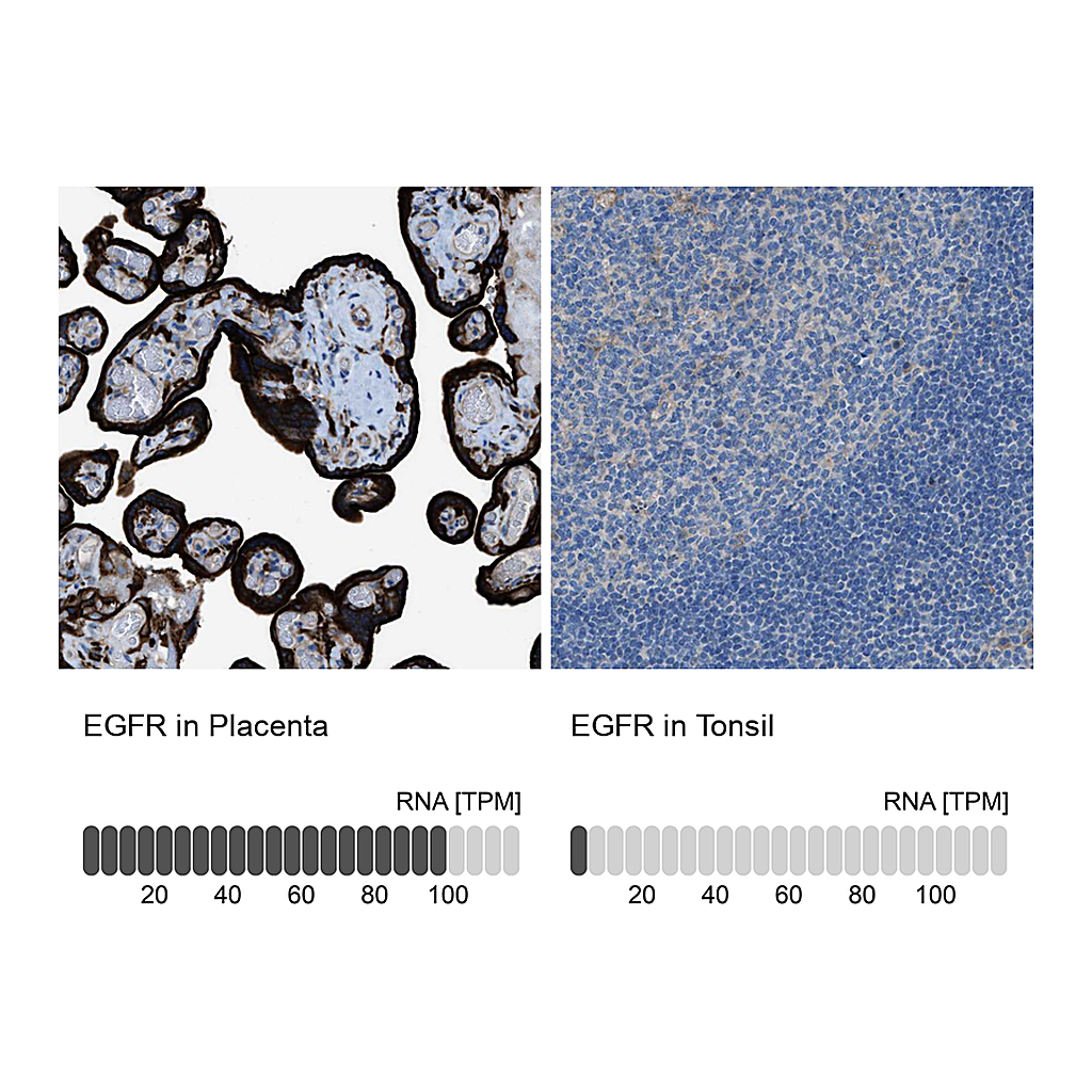 Atlas Antibodies Anti-EGFR Antibody