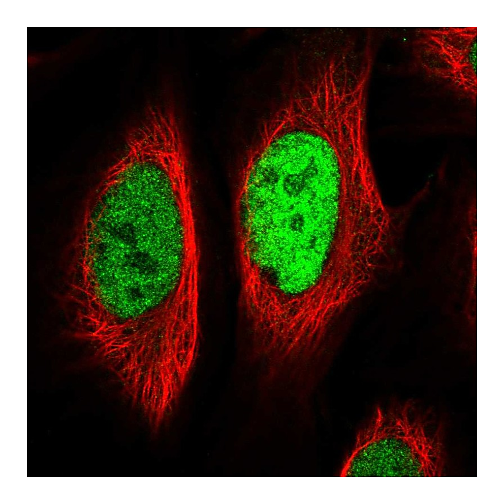Atlas Antibodies Anti-EGR1 Antibody