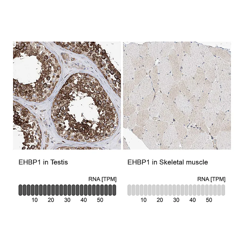 Atlas Antibodies Anti-EHBP1 Antibody