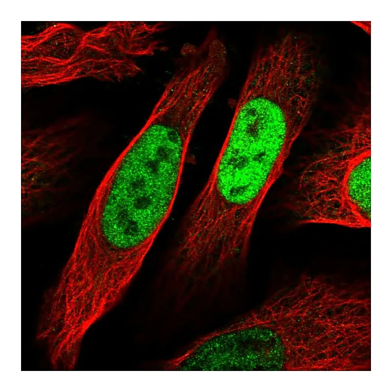 Atlas Antibodies Anti-EGR1 Antibody