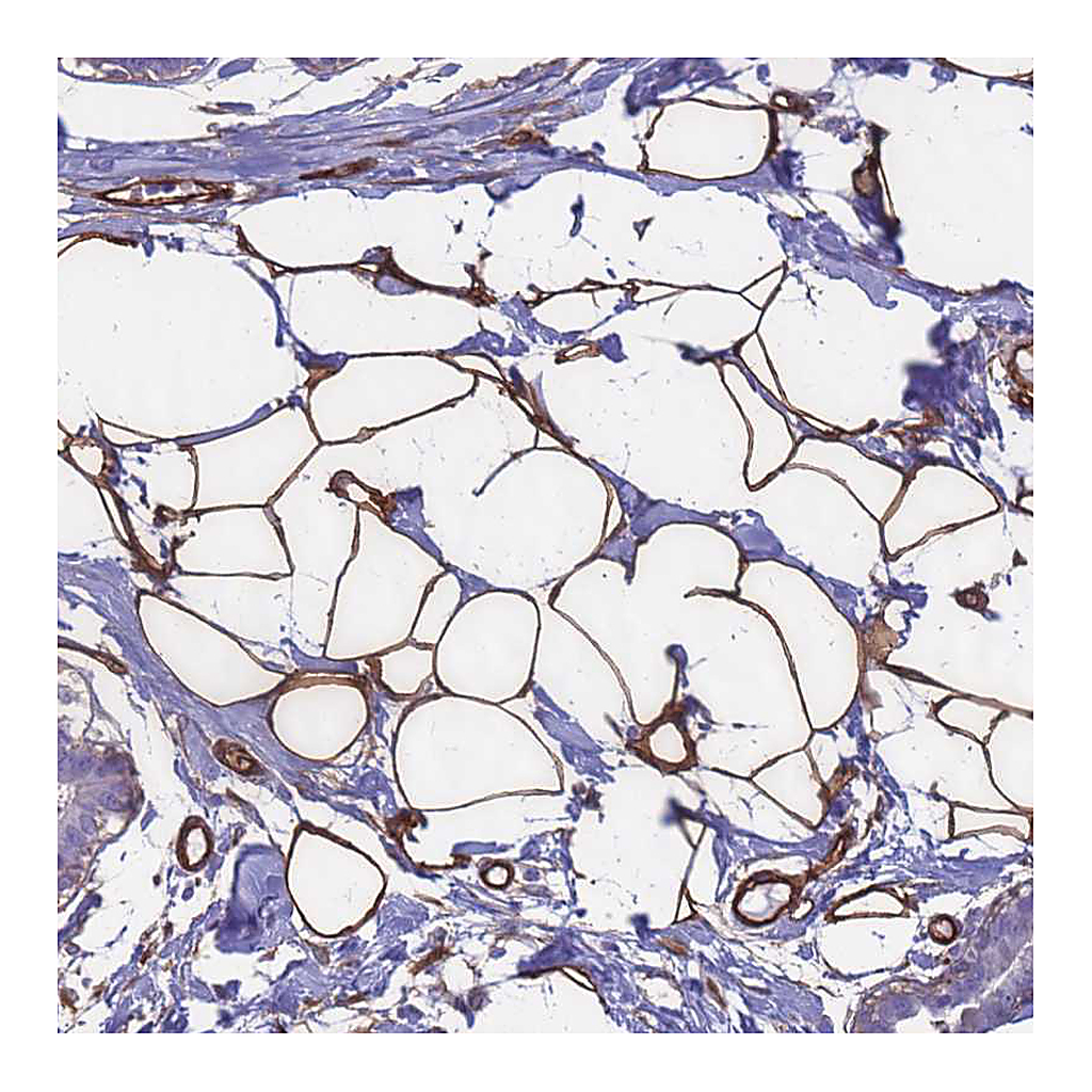 Atlas Antibodies Anti-EHD2 Antibody