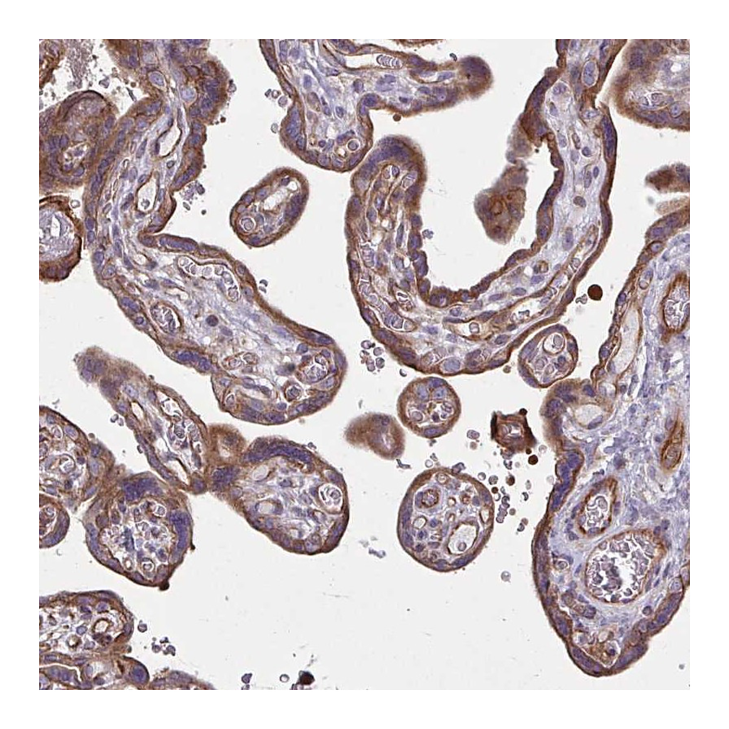 Atlas Antibodies Anti-EID2B Antibody