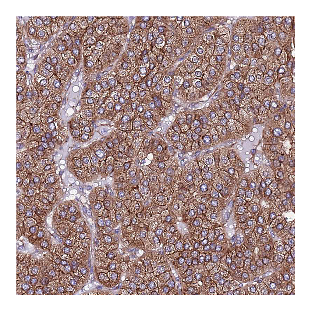 Atlas Antibodies Anti-EI24 Antibody
