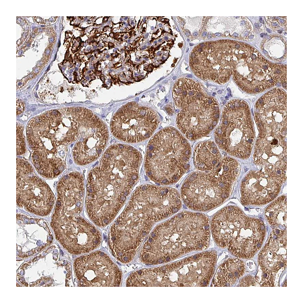 Atlas Antibodies Anti-EIF1AD Antibody