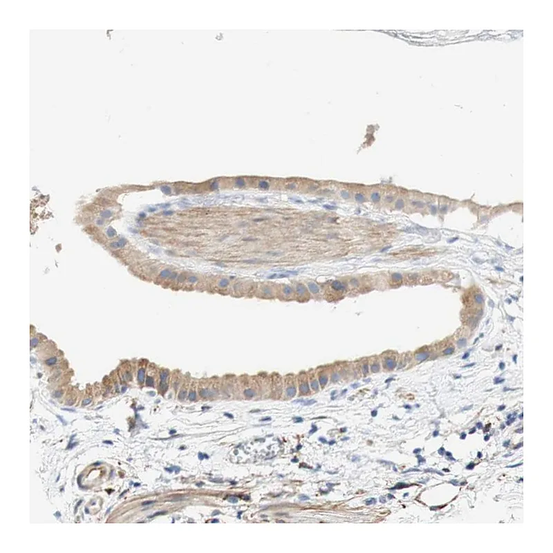 Atlas Antibodies Anti-EIF2AK4 Antibody