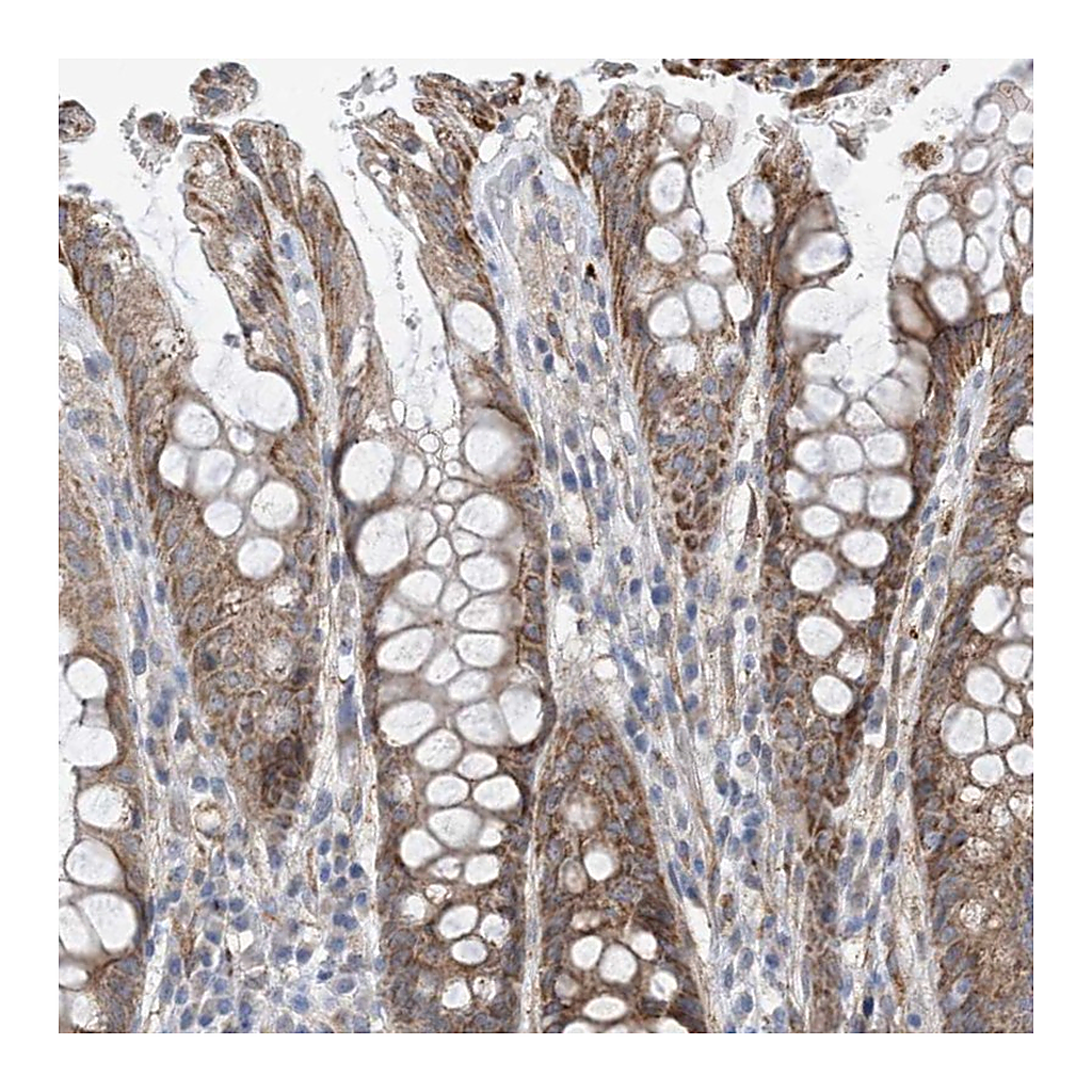 Atlas Antibodies Anti-EIF2A Antibody