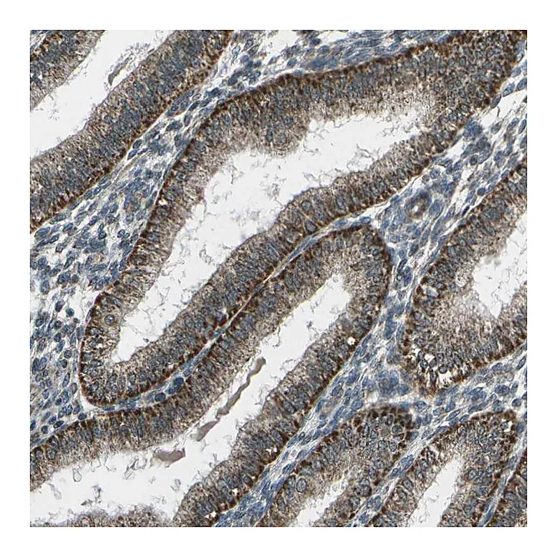 Atlas Antibodies Anti-EIF2AK1 Antibody