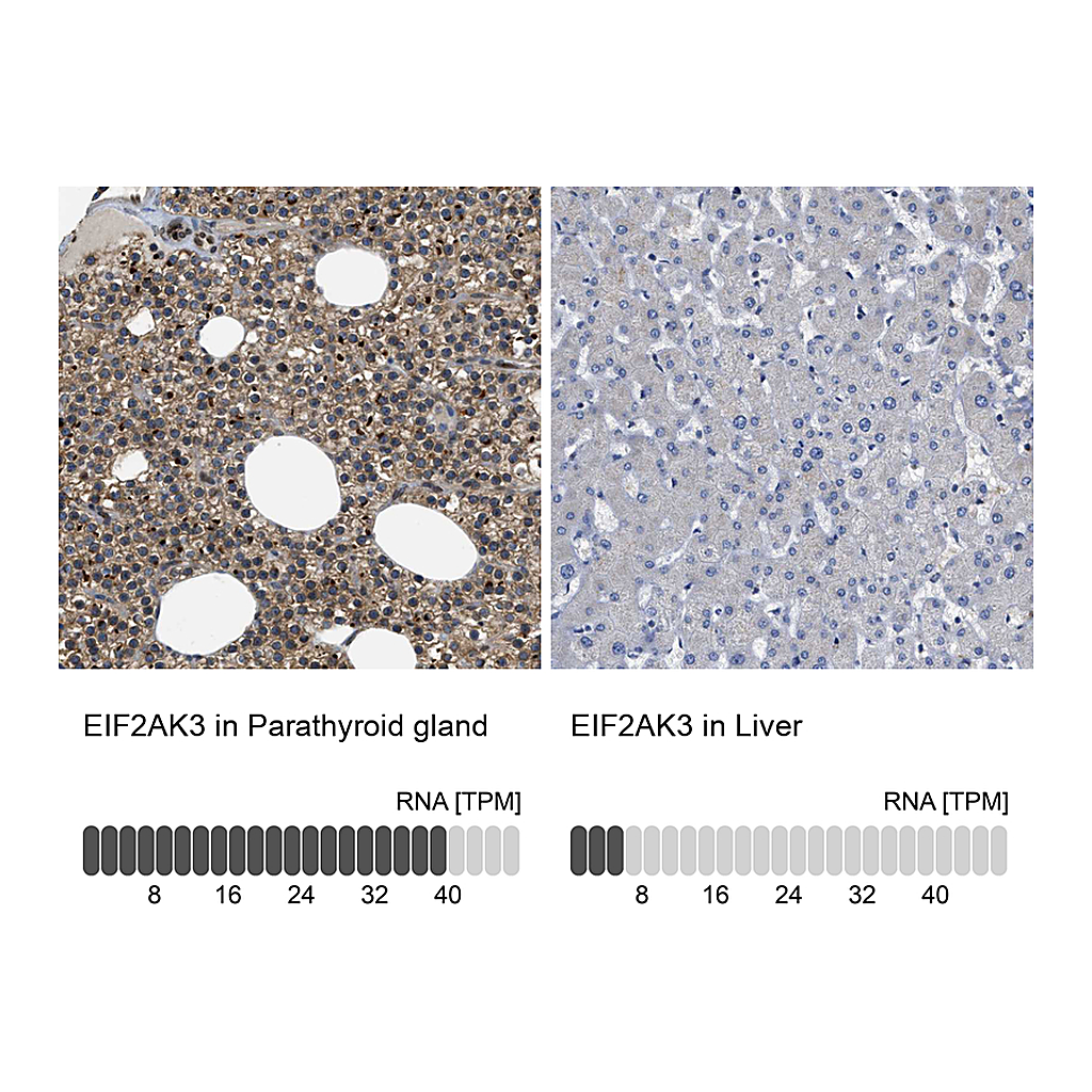 Atlas Antibodies Anti-EIF2AK3 Antibody