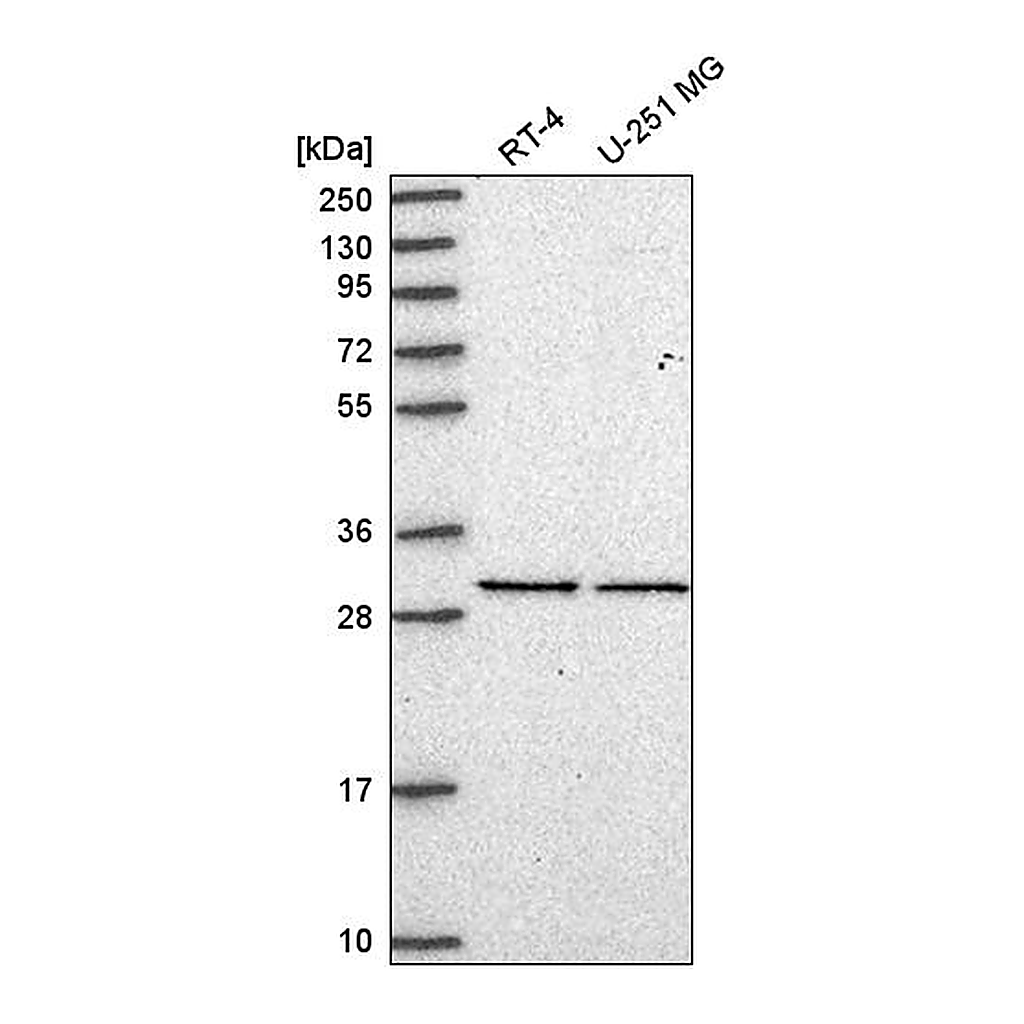 Atlas Antibodies Anti-EIF2B1 Antibody