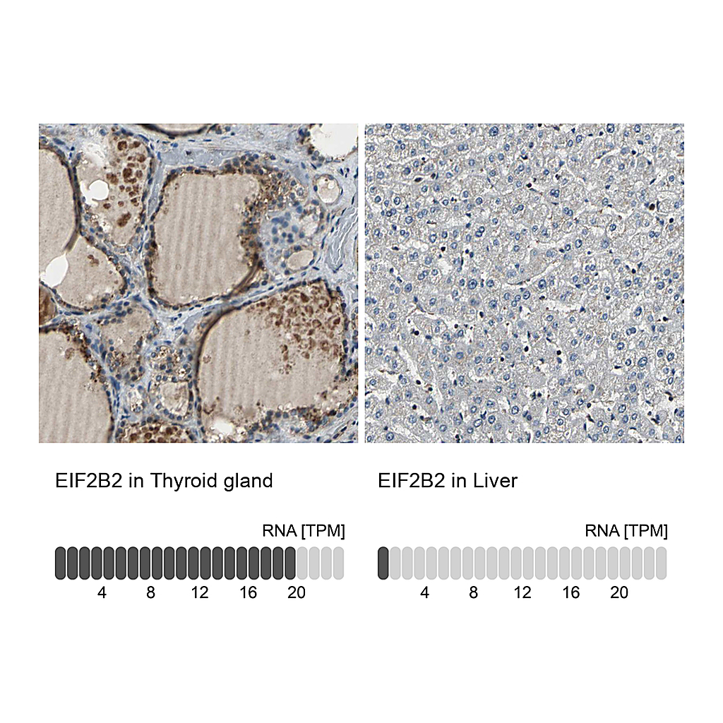 Atlas Antibodies Anti-EIF2B2 Antibody