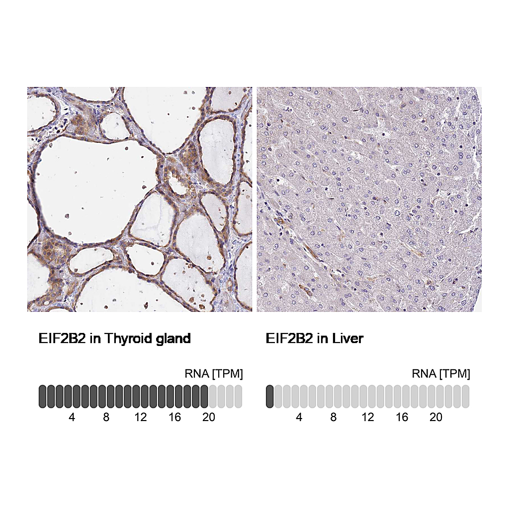 Atlas Antibodies Anti-EIF2B2 Antibody