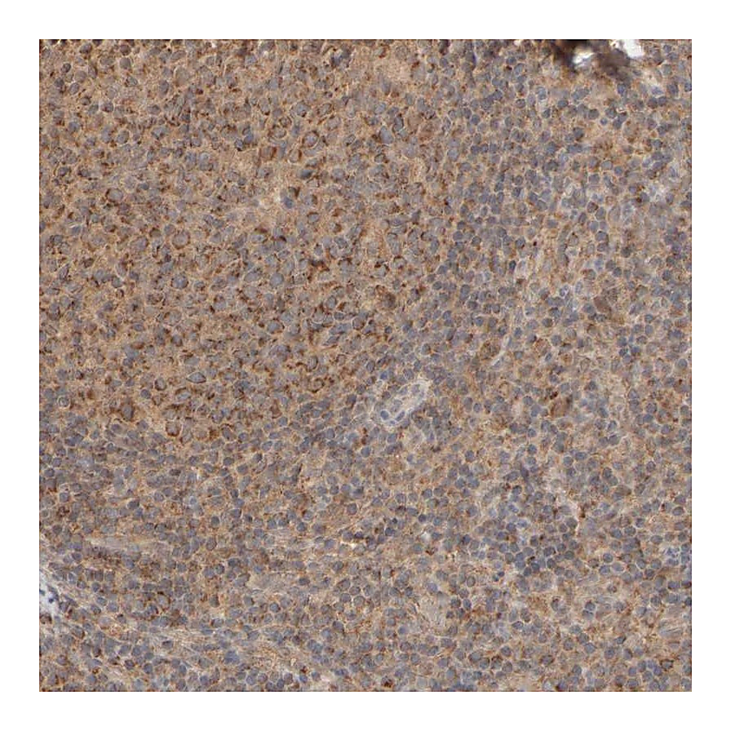 Atlas Antibodies Anti-EIF2B3 Antibody