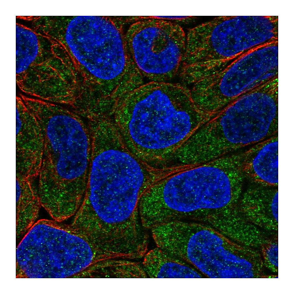 Atlas Antibodies Anti-EIF2B5 Antibody