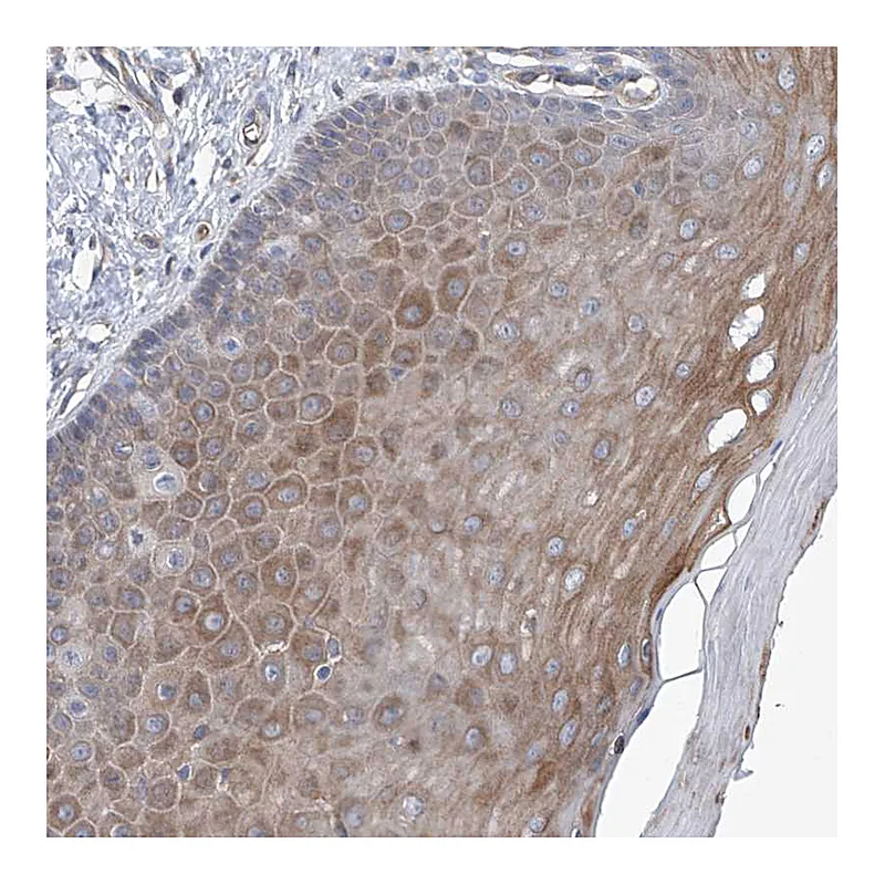 Atlas Antibodies Anti-EIF2D Antibody