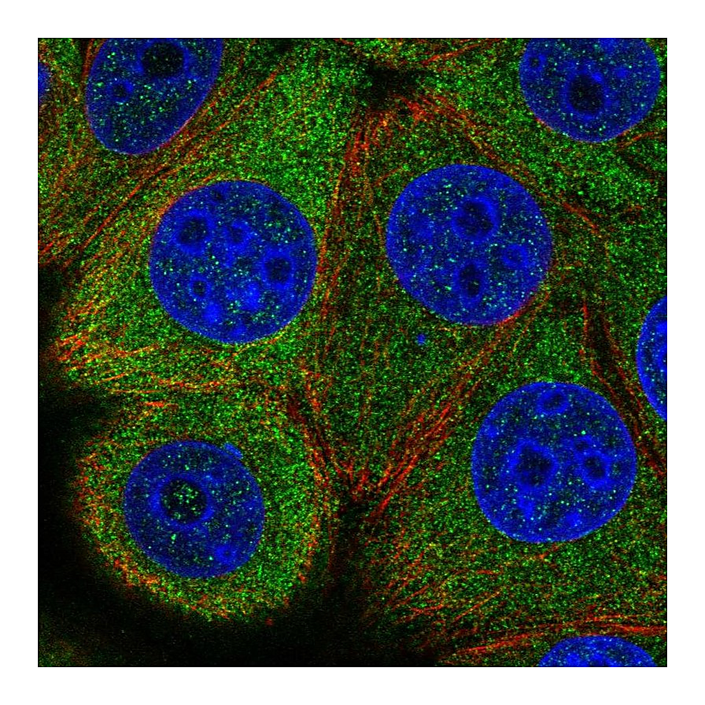 Atlas Antibodies Anti-EIF2B5 Antibody