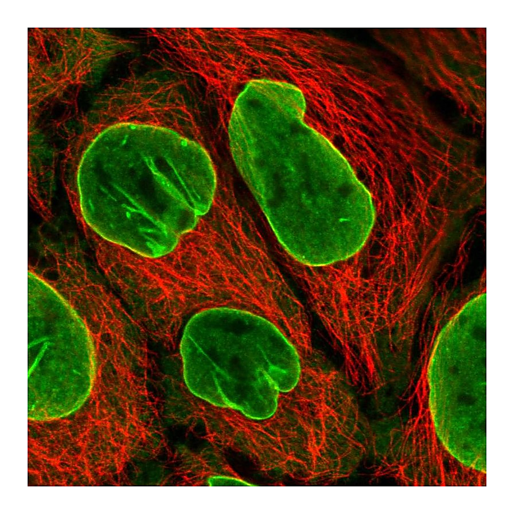 Atlas Antibodies Anti-EIF2B4 Antibody