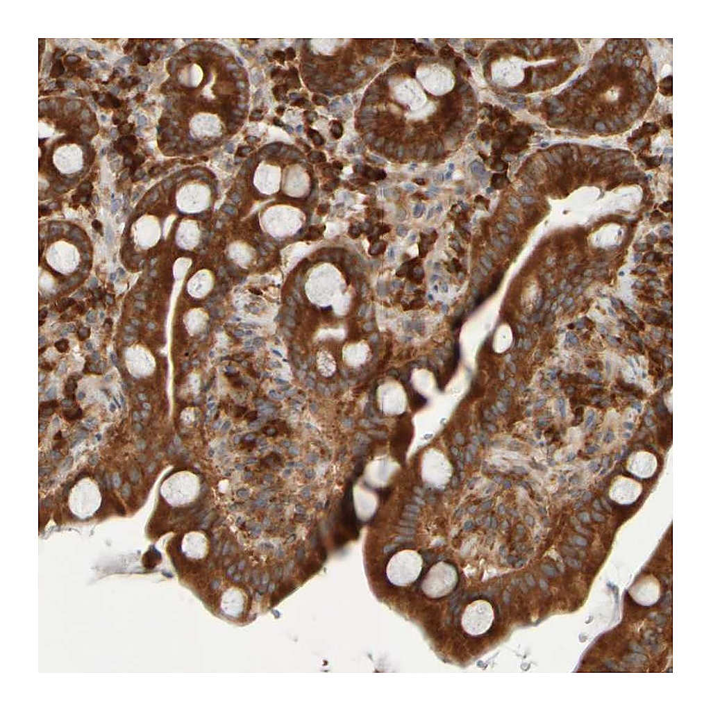 Atlas Antibodies Anti-EIF2B3 Antibody